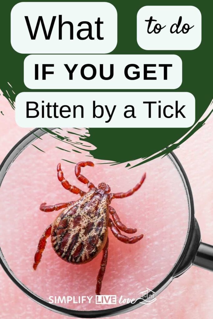 Pinterest photo with wood tick under microscope and words what to do if you get bitten by a tick